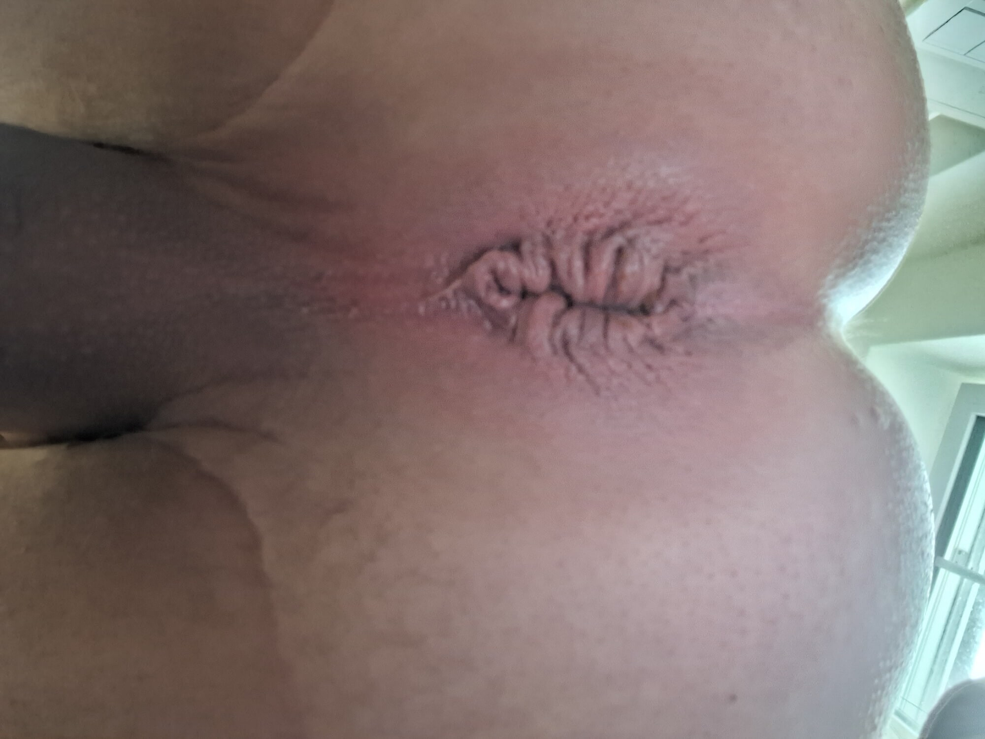 got my asshole pumped and swollen #2