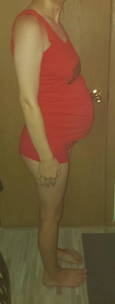 Photos #11