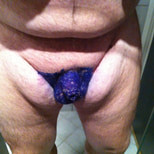 Micropenis #11