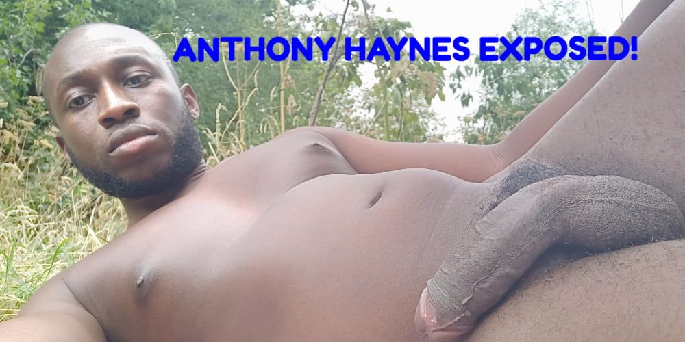 Anthony Haynes Exposed #10
