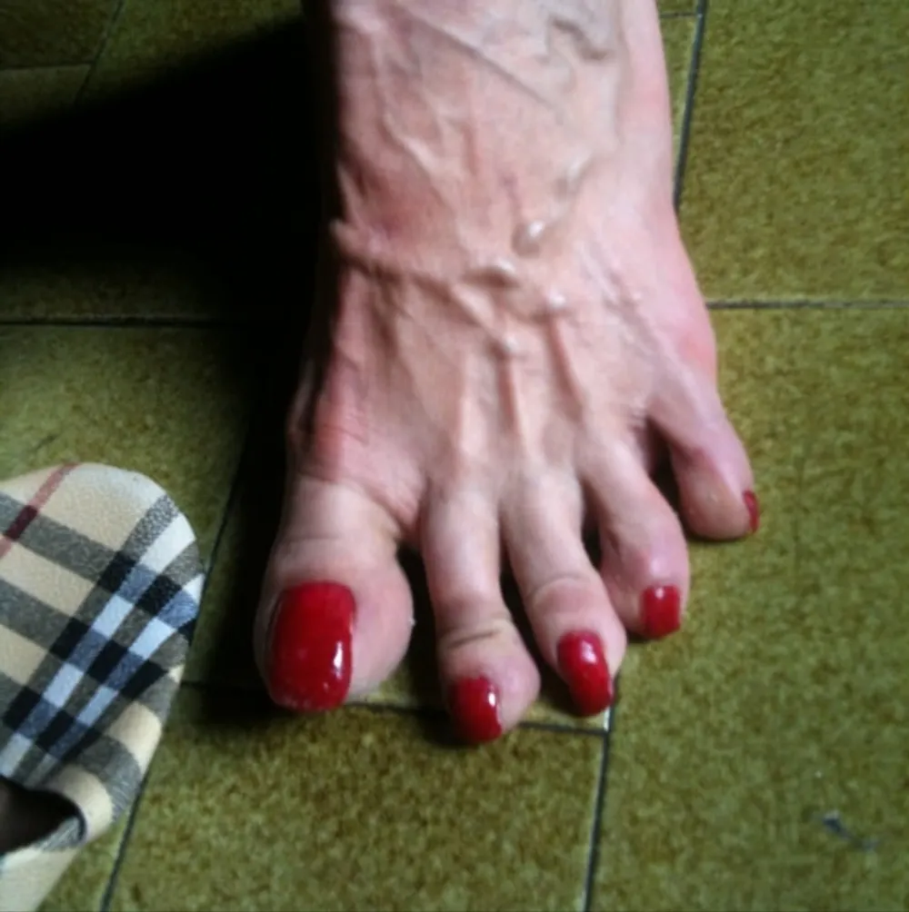 red toenails mix (older, dirty, toe ring, sandals mixed). #7