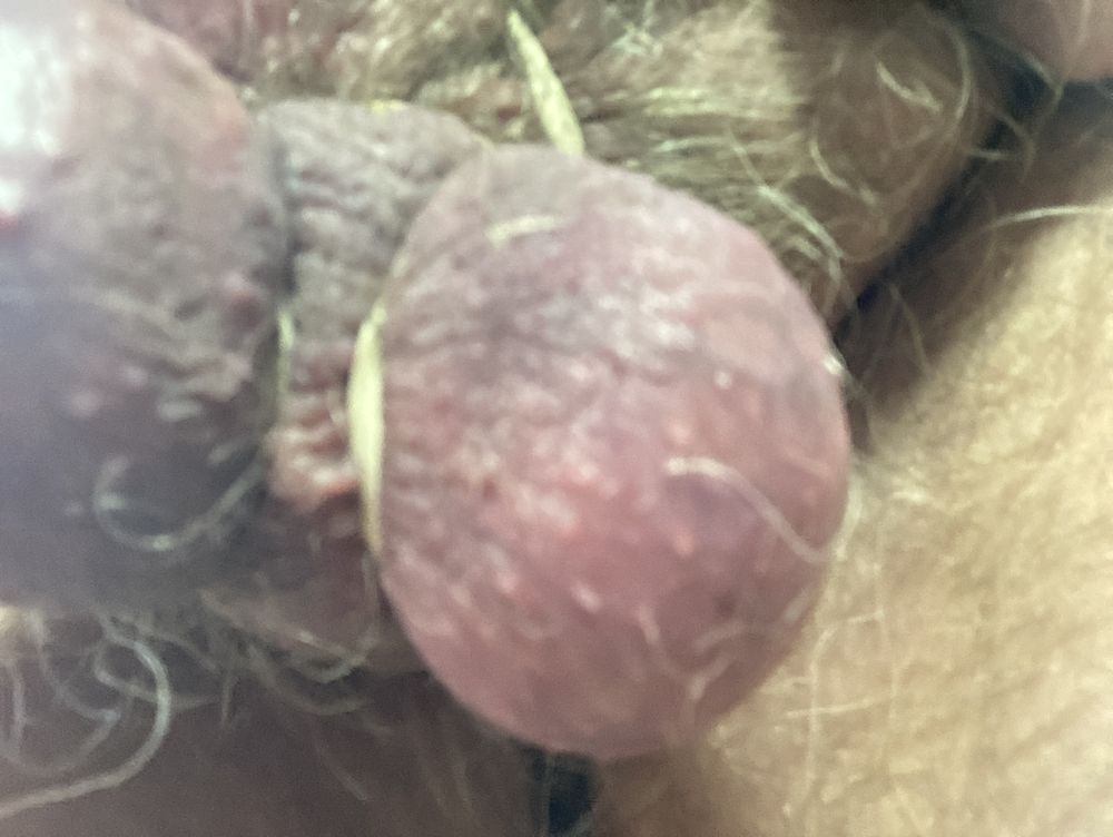 my tortured cock pics 2 #13