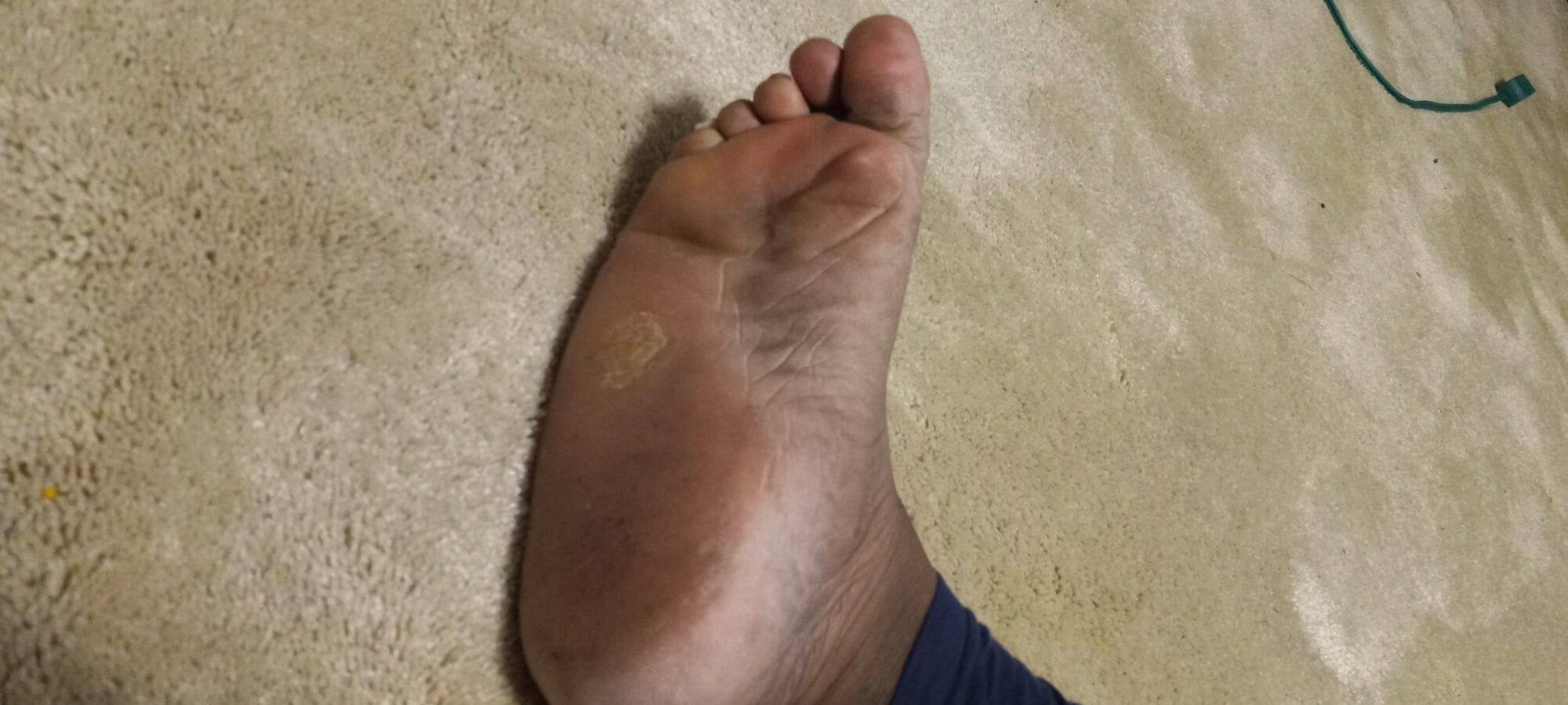 Pics of my Feet #9