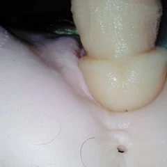 Clone a Willy