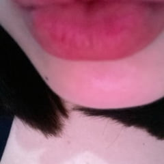 Kisses 💋 