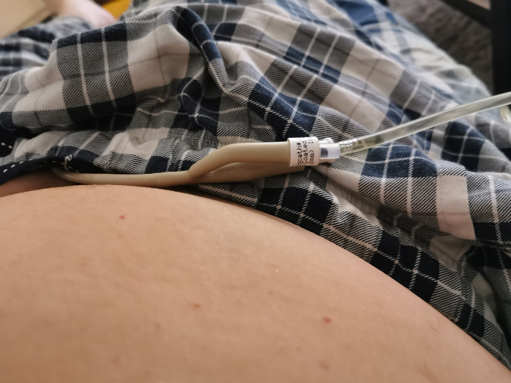 Katetern insatt idag  #3
