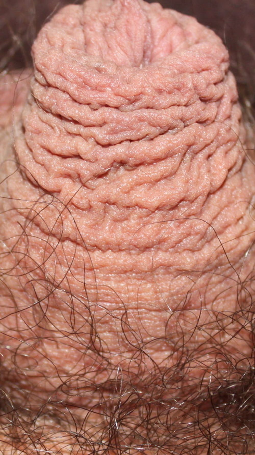 My foreskin #37