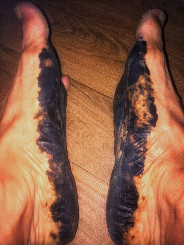 My feet with henna tattoo