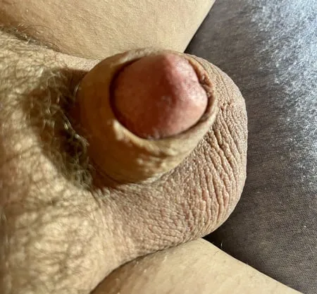 tiny penis micro cock inverted cock photos         