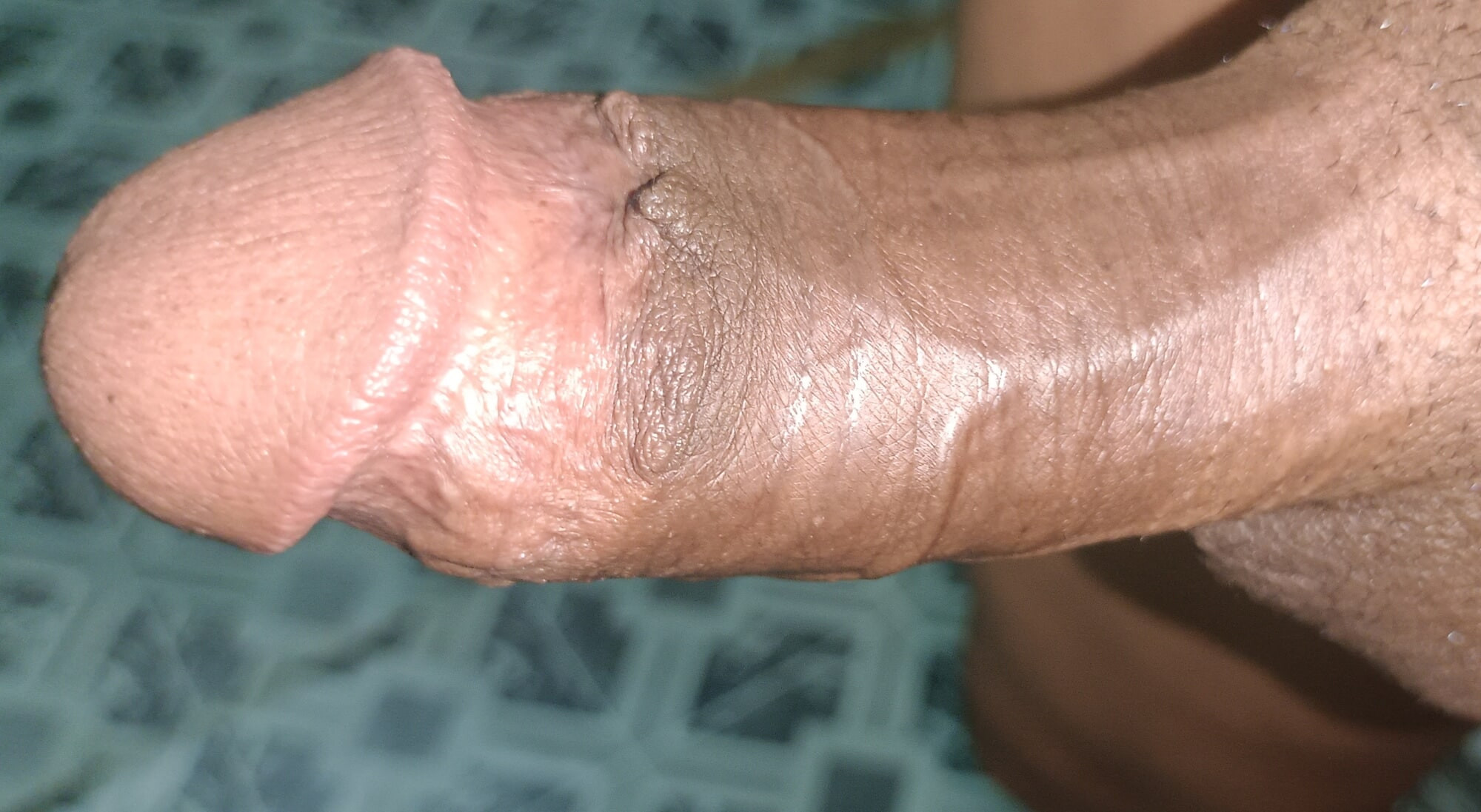Penis