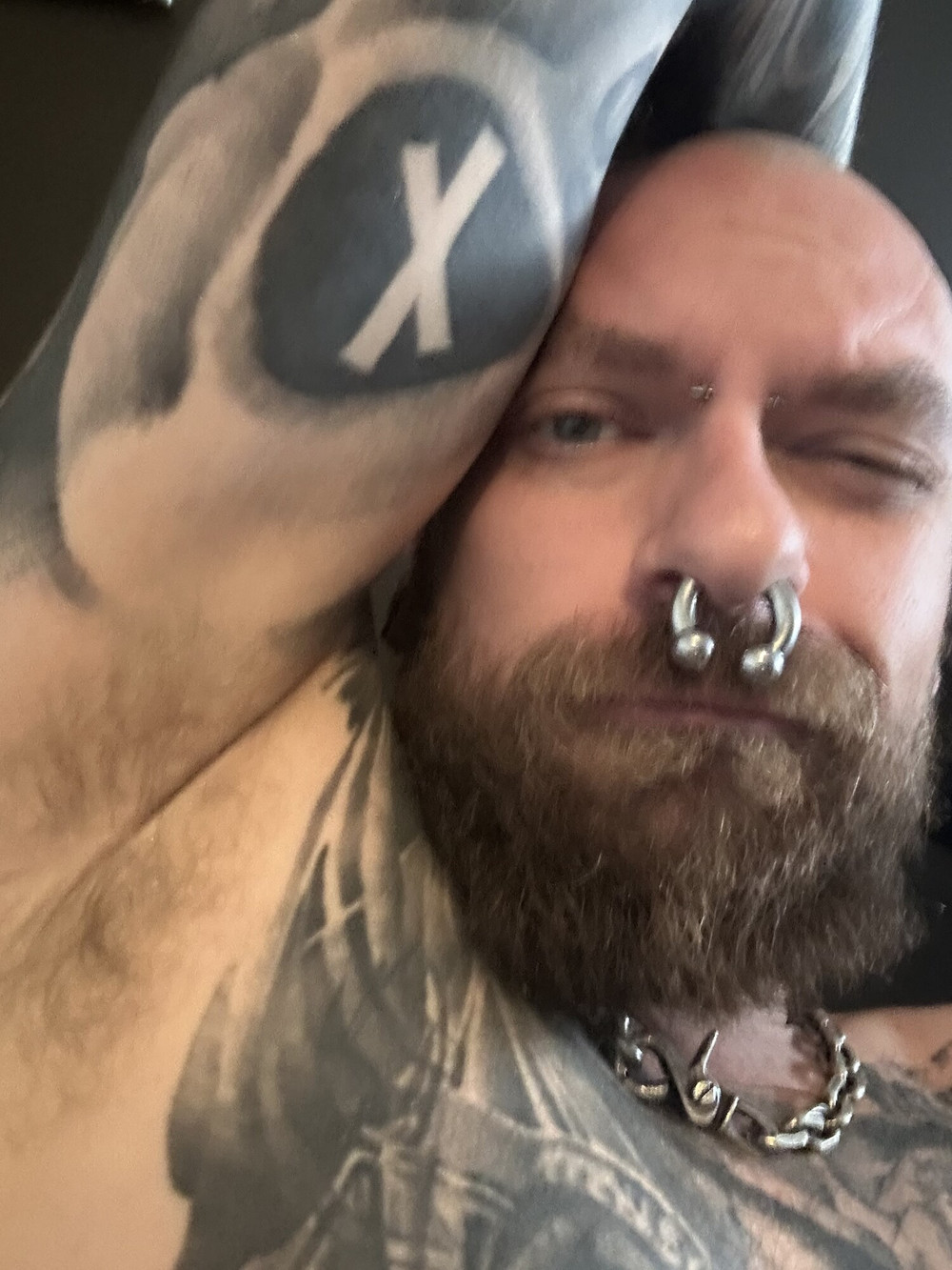 Smelly pits #2