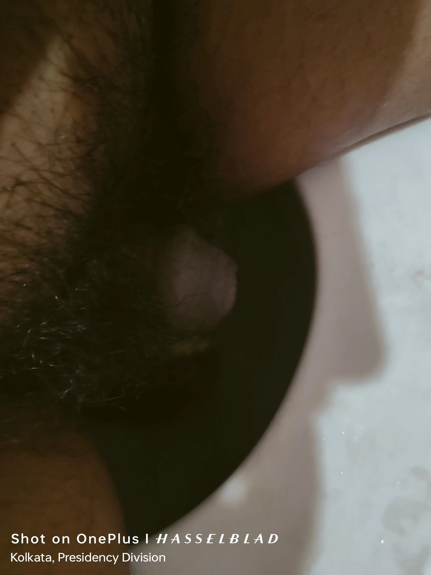 Pennis