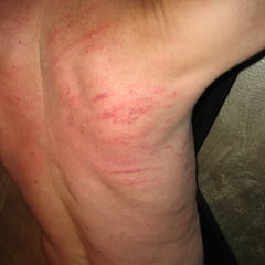 Spanking