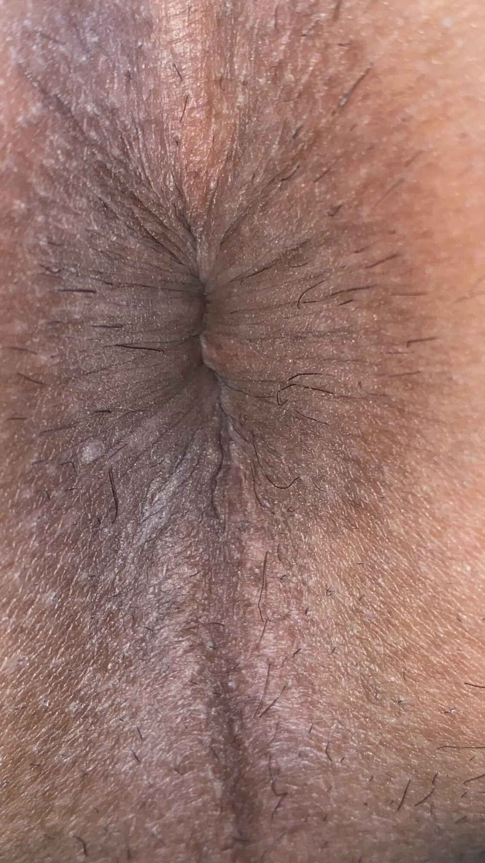 Close-up of a man&#039;s anus #60