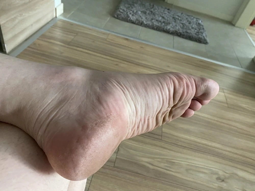 Just my wrinkled soles #18