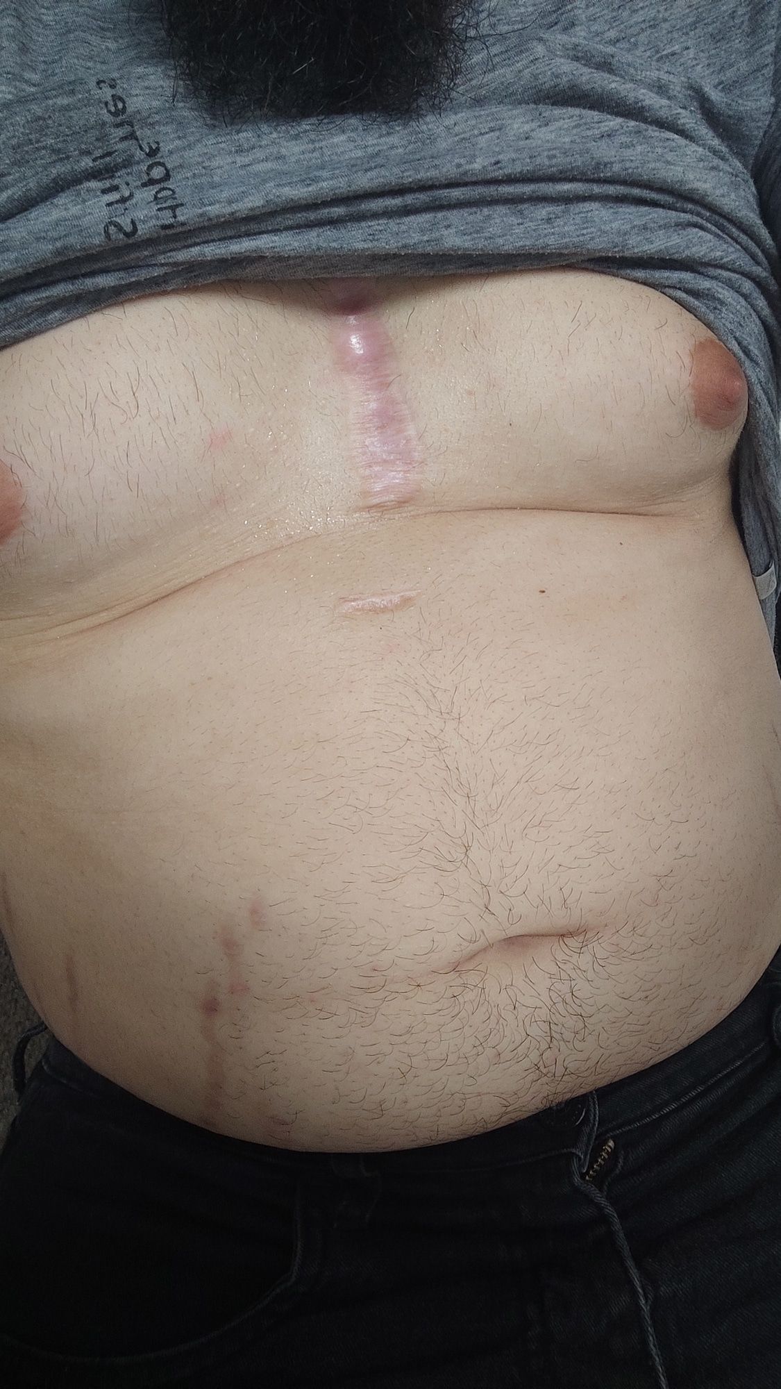My belly and my chest #2