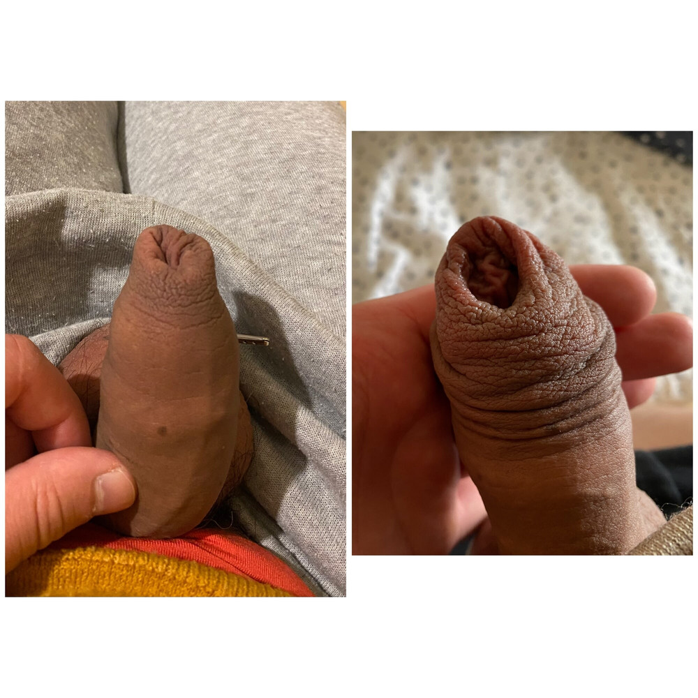 Foreskin stretching #3