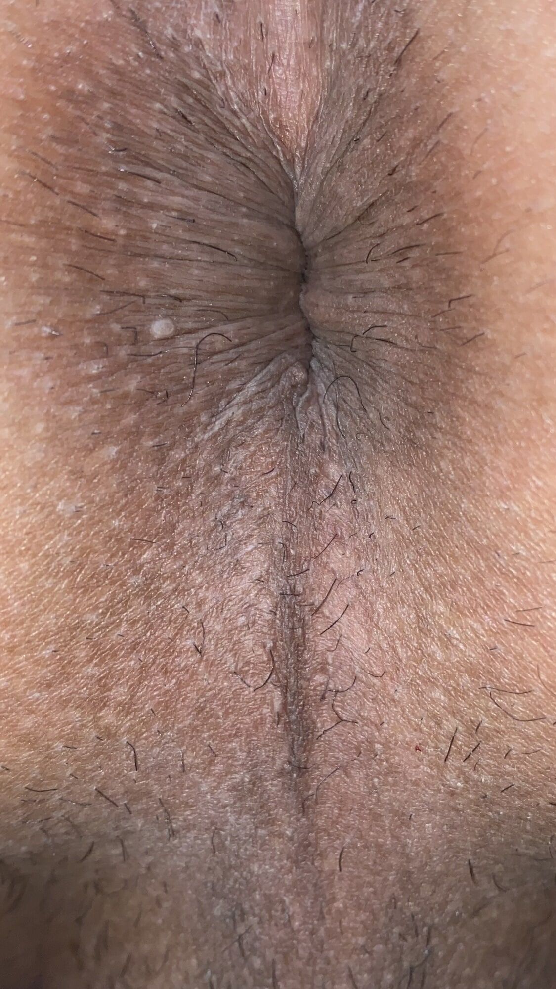 Close-up of a man's anus #12
