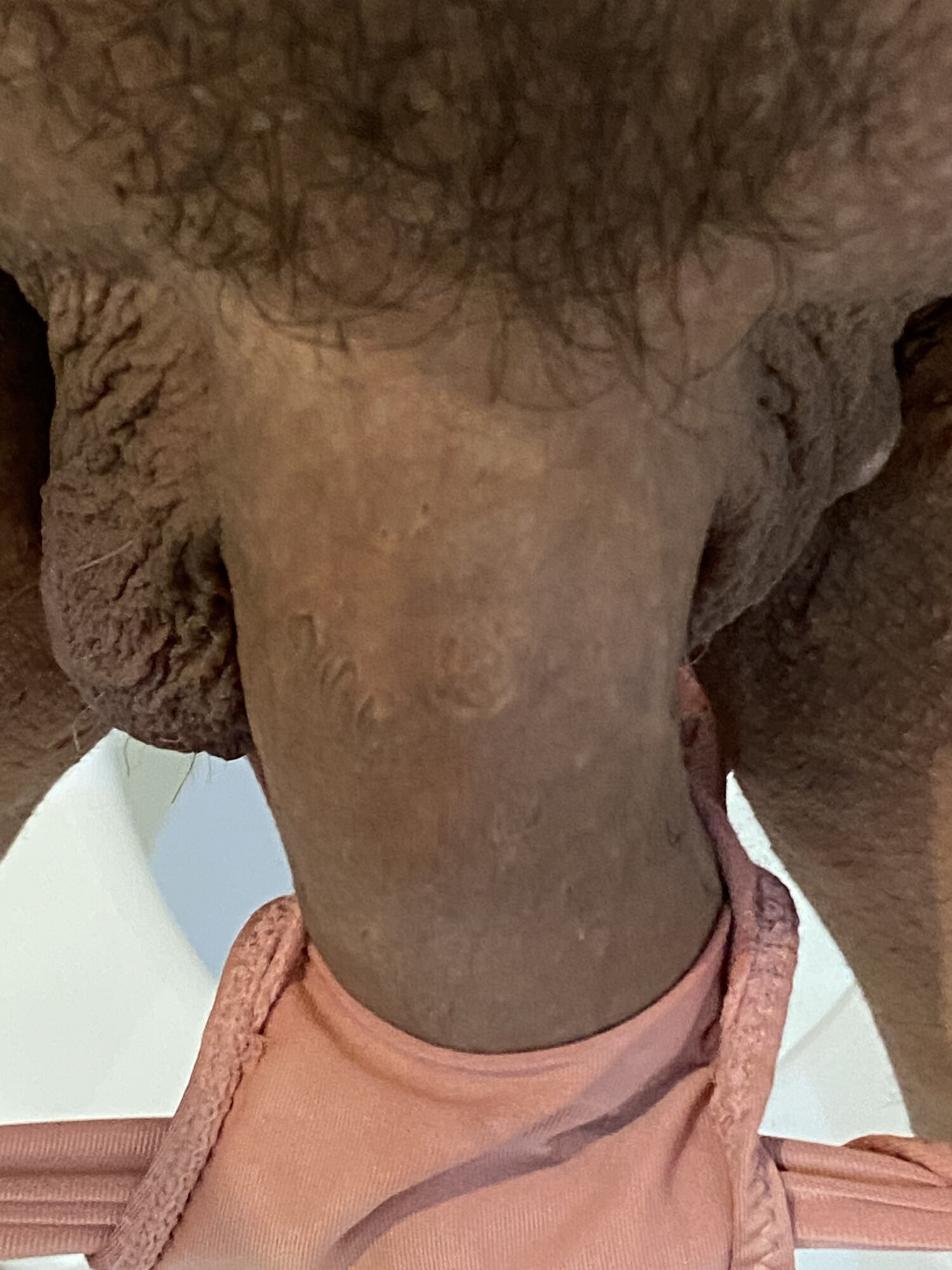 Yo1 #2