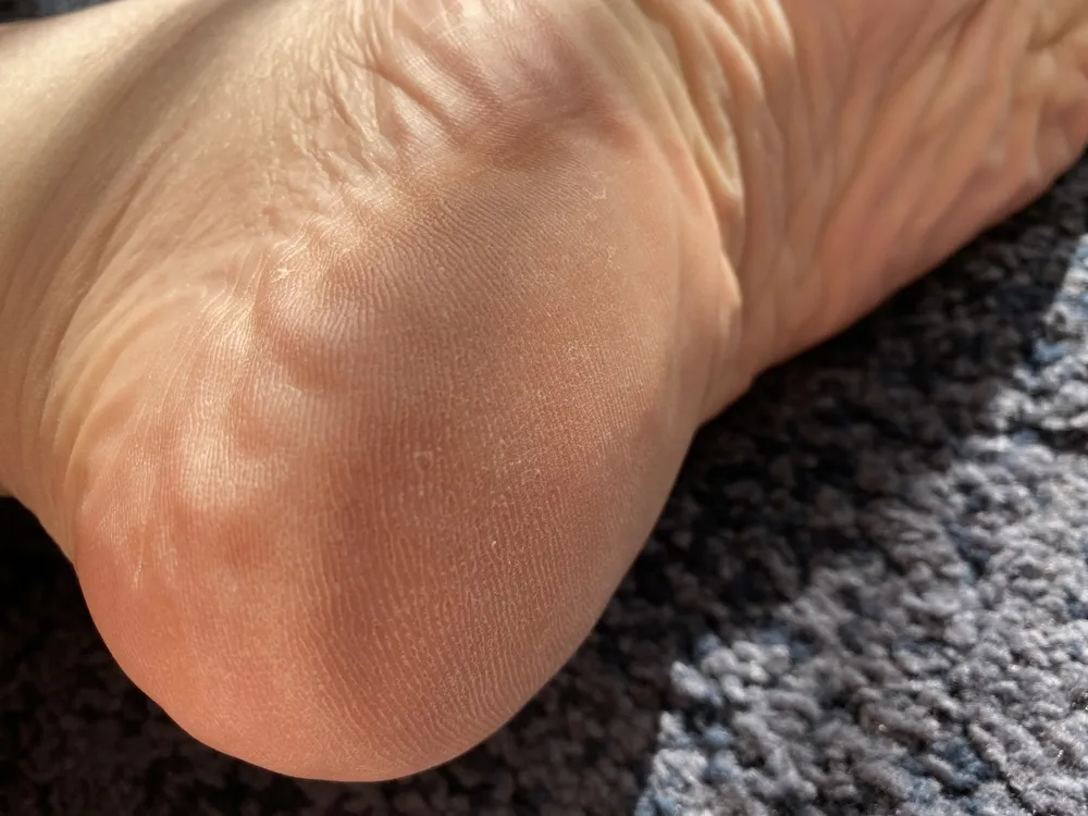 My beautiful male soles #10