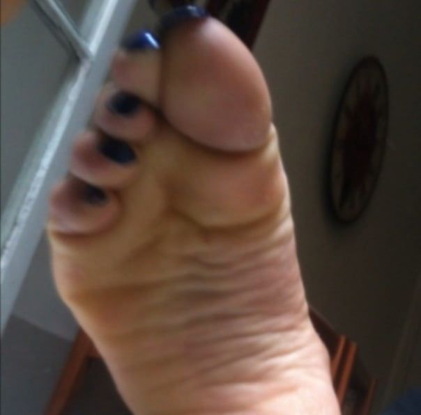 blue toenails and soles feet after day at beach  #14
