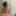 My body