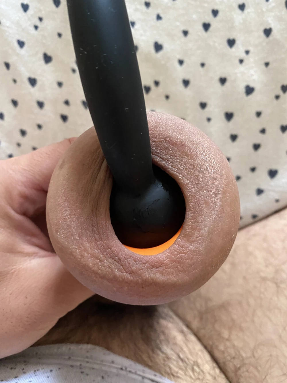 Extreme foreskin inflation #4