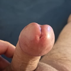 Mano penis 