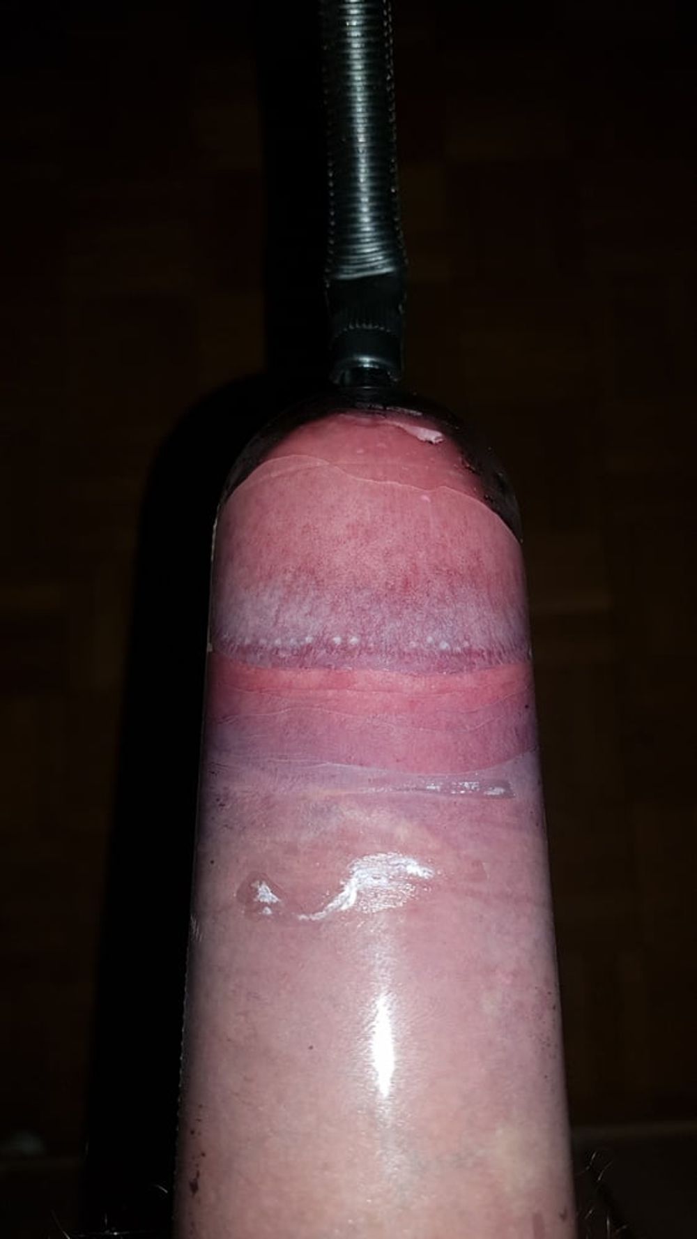 Penis pump #7