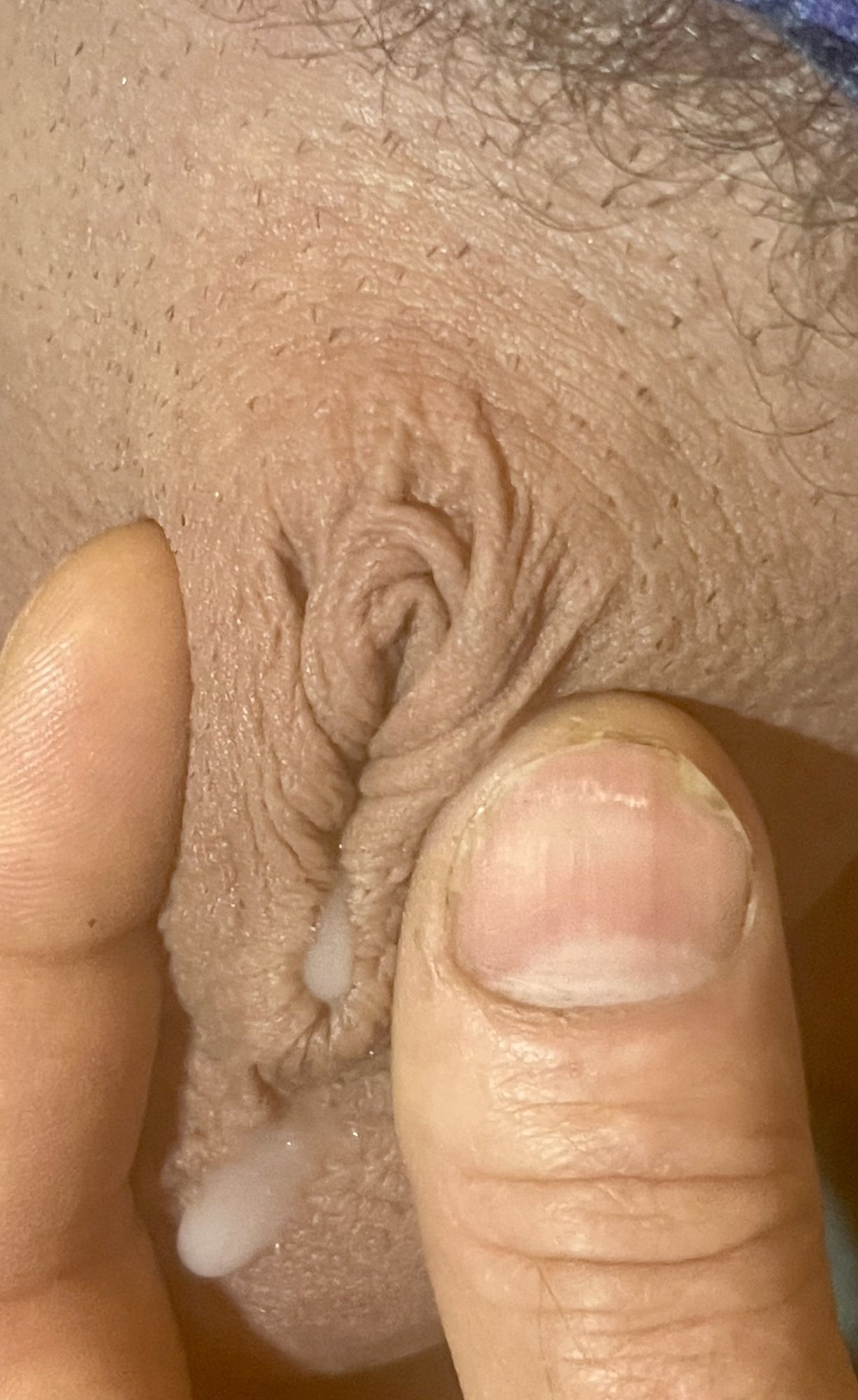Micropenis lady, boy, cock pic #17