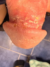 Acorn cheese or nub cheese