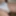 Uncut Penis 