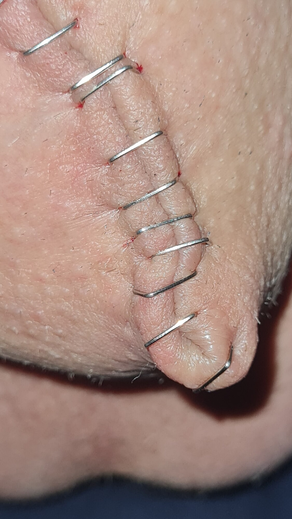 Stapled cock and balls #9