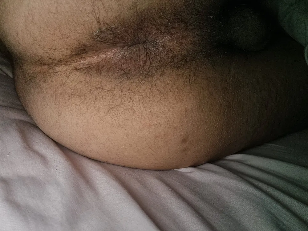 Rich hairy #5