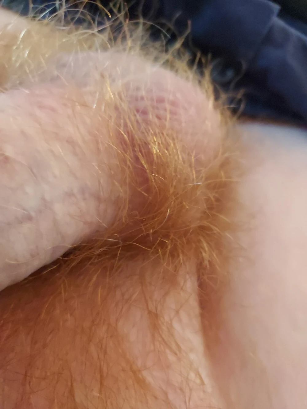 Fire bush #5