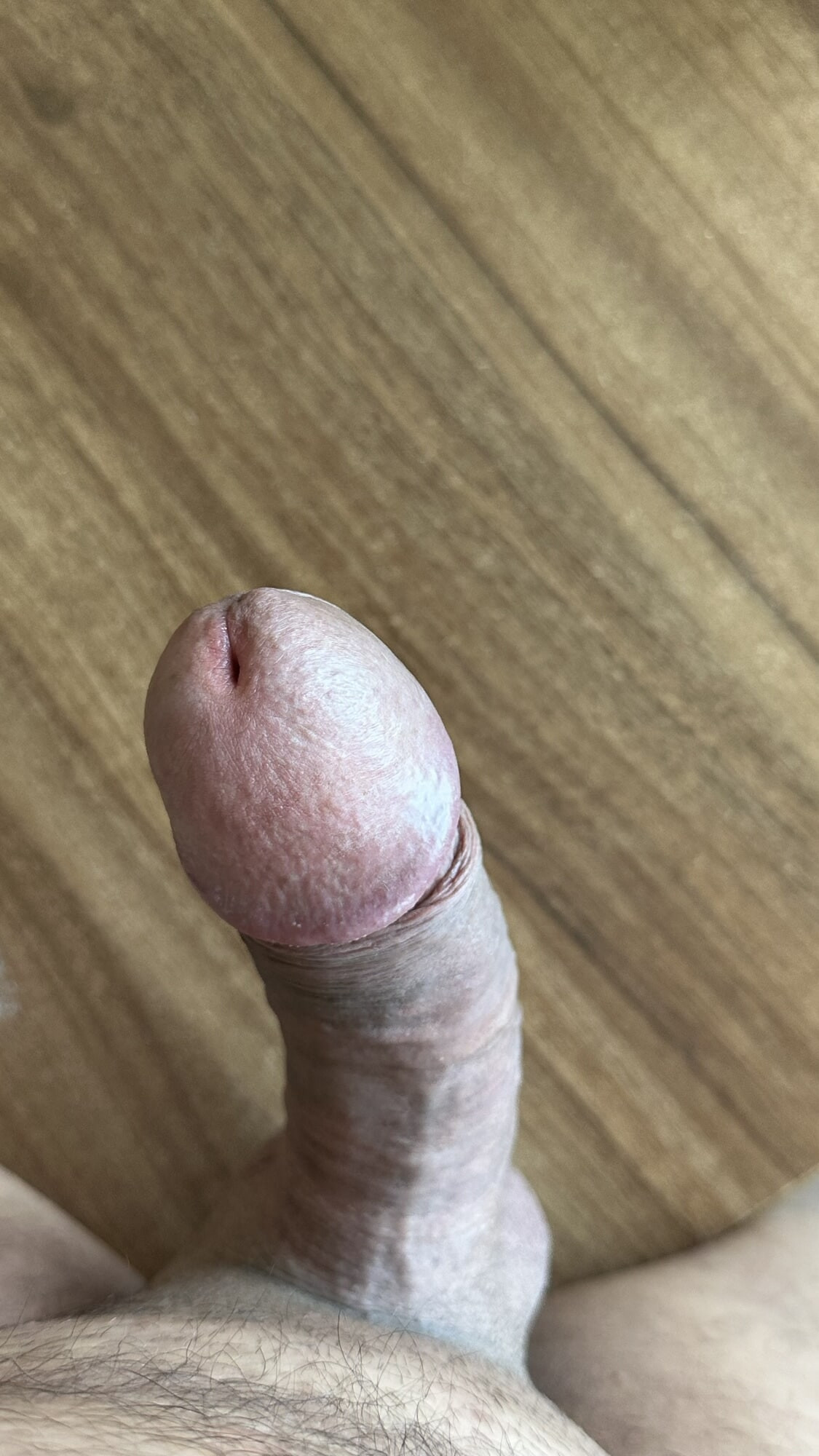 Penis
