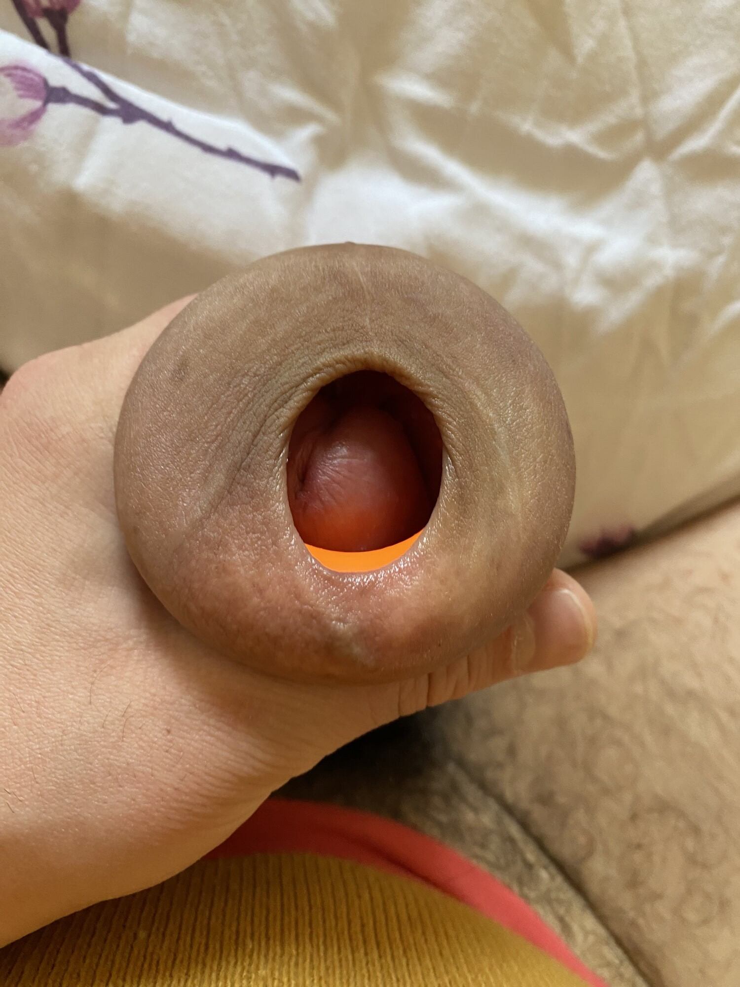 Extreme stretching foreskin #3