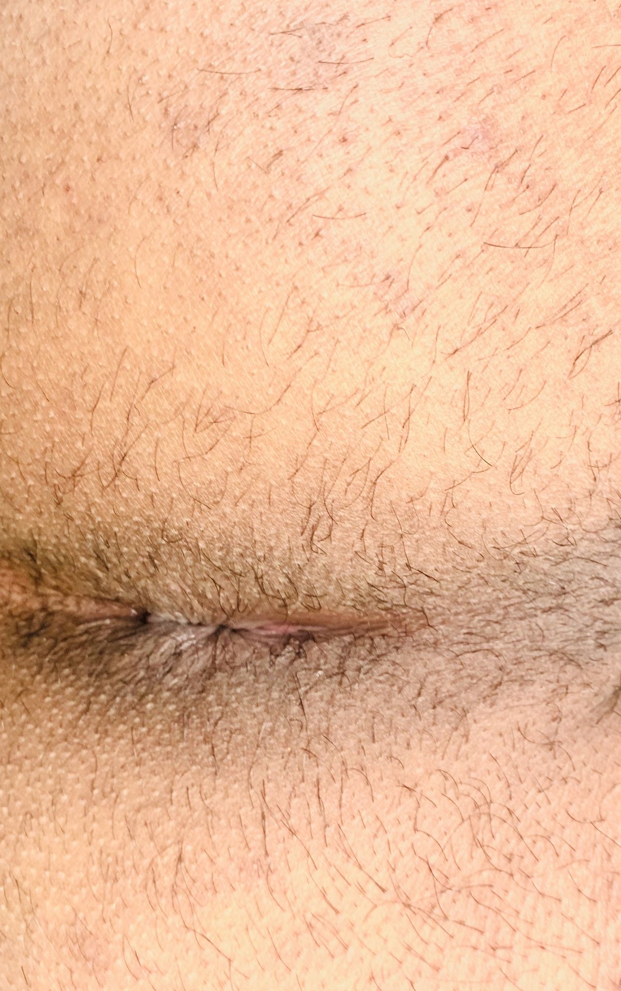 Close up Asshole #5