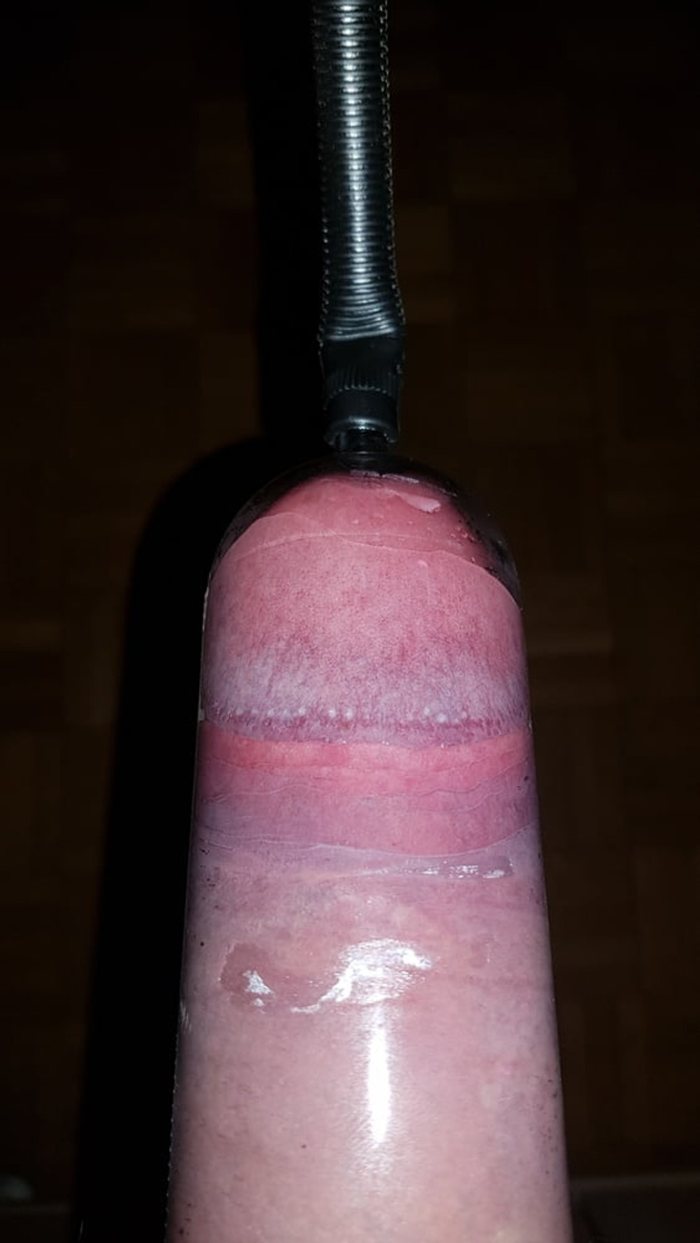 Penis pump #5