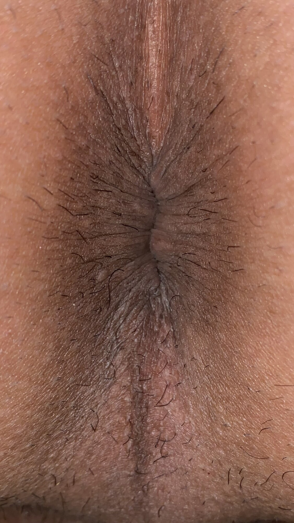 Close-up of a man&#039;s anus #38