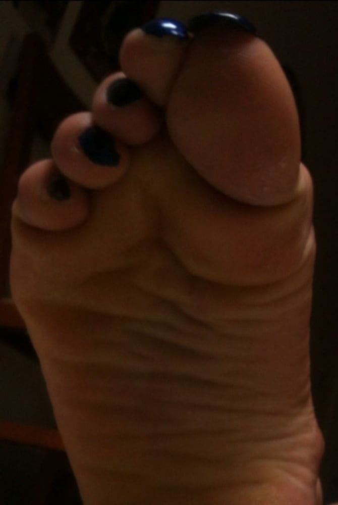 blue toenails and soles feet after day at beach  #8