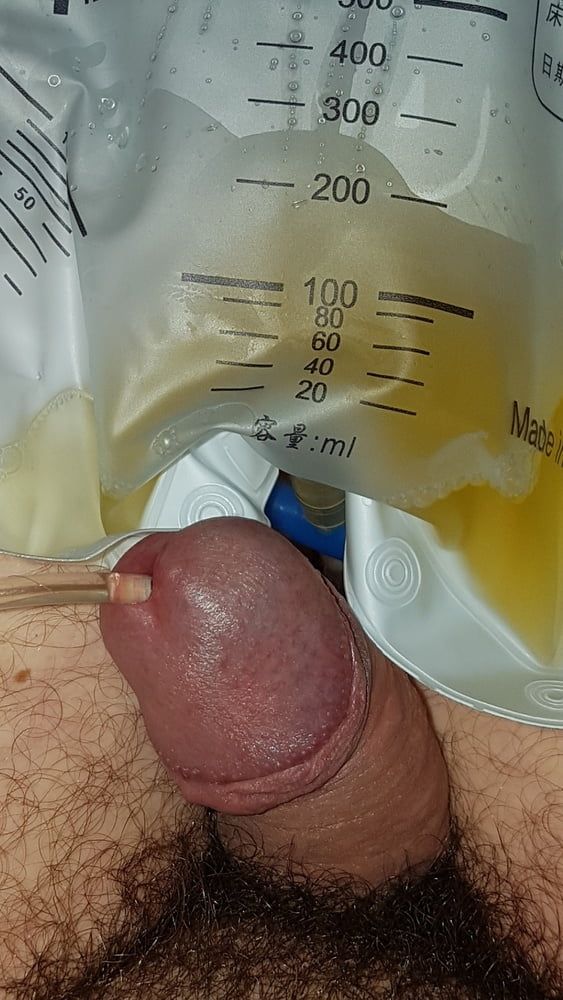 Catheter sounding with my urine 2 #26