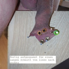 20230311_Foreskin cutting