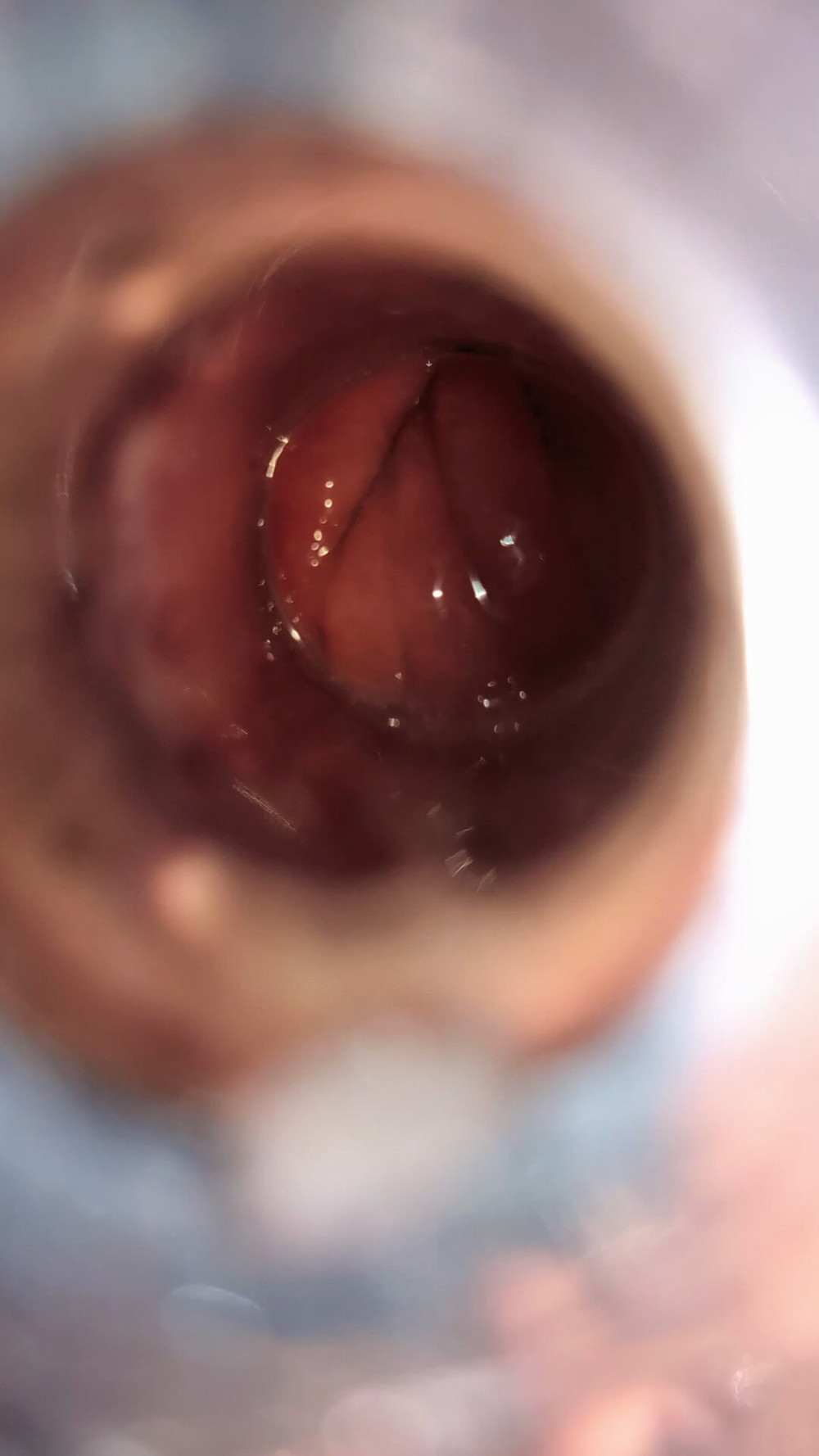 Tunnel Plug #4