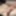 Foreskin