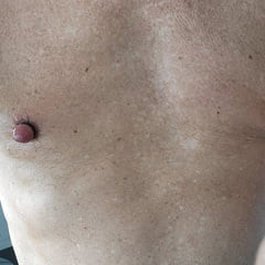 nipple pumping