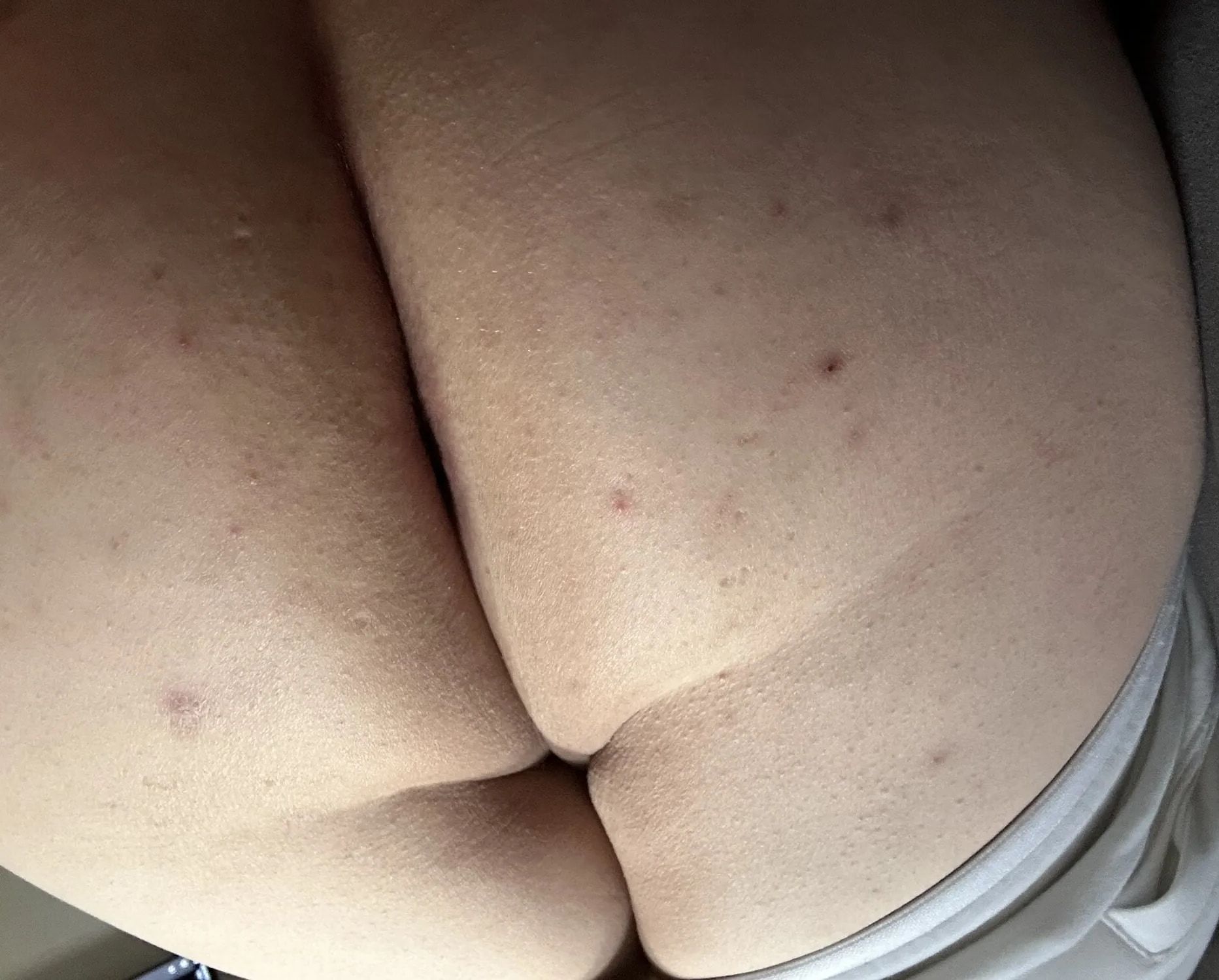 My Fat Slut Body #37