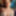 Bruised Redhead Ass from XHamster Live Show - Week 207 #5