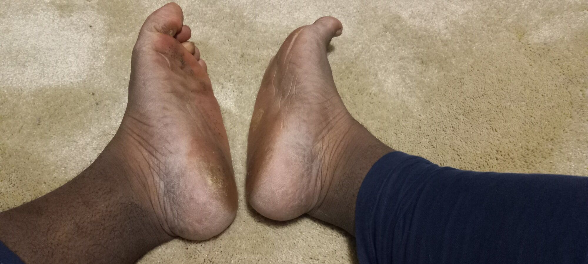 Pics of my Feet #18