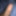 My foreskin